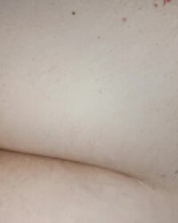 photo-thumb