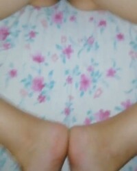 photo-thumb