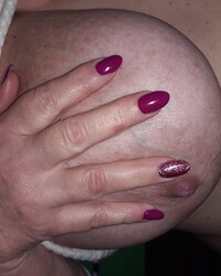 photo-thumb