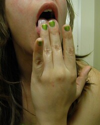 photo-thumb