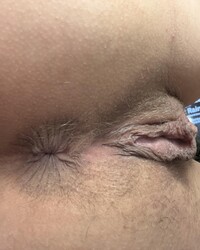 photo-thumb