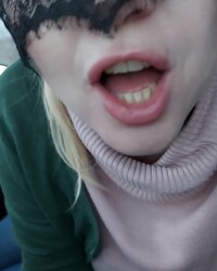 photo-thumb
