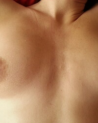 photo-thumb