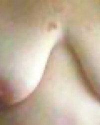 photo-thumb