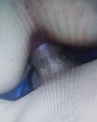 photo-thumb