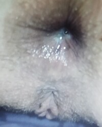 photo-thumb