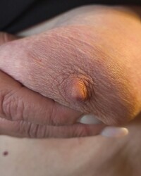 photo-thumb