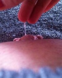 photo-thumb