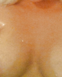 photo-thumb