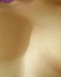 photo-thumb
