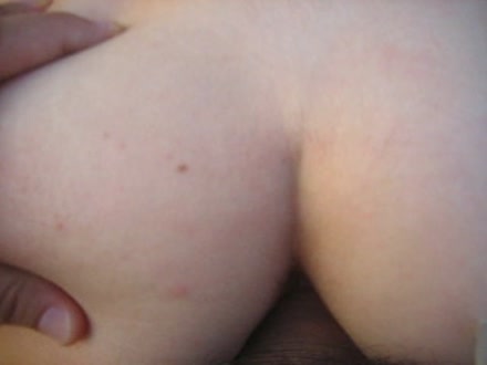 Thumb 10