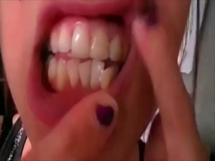 Thumb 13