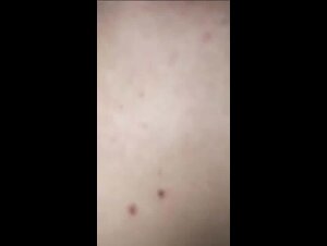 Thumb 6