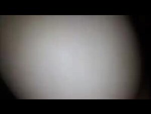 Thumb 8
